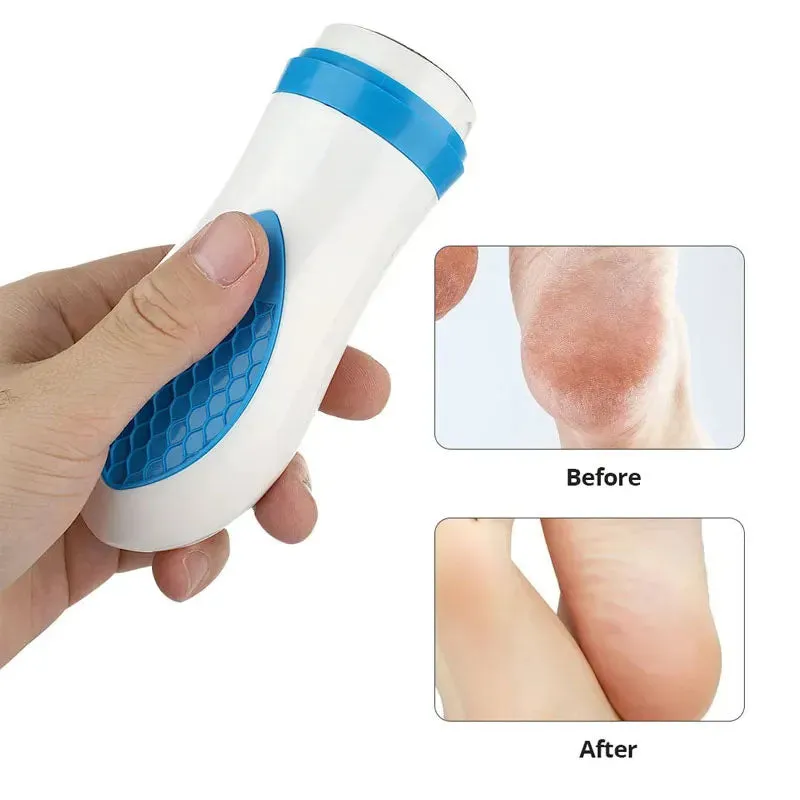 Pedi Skin Callus Remover